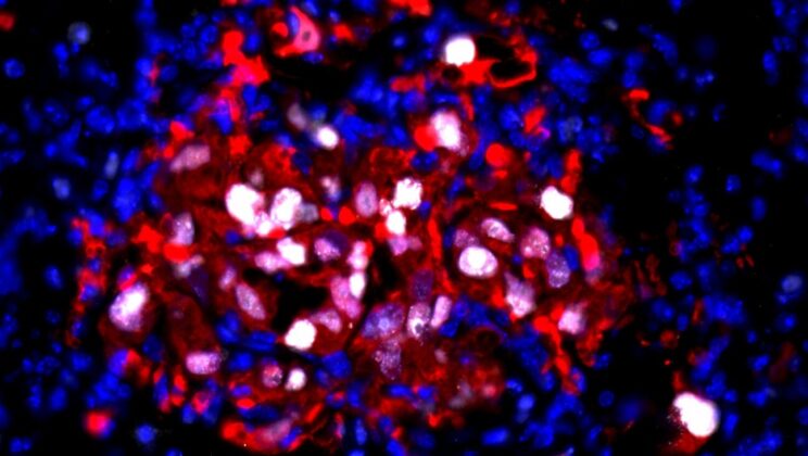 Scientists Uncover the Hidden Signal That Wakes Sleeping Cancer Cells After Years of Silence