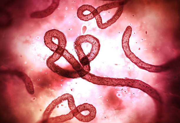 Ebola Virus Disease: Causes, Symptoms, Diagnosis, and Treatment