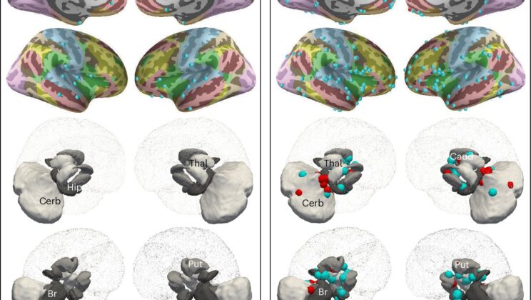 Scientists Map the Hidden Brain Changes Behind Schizophrenia—And It Could Transform Treatment