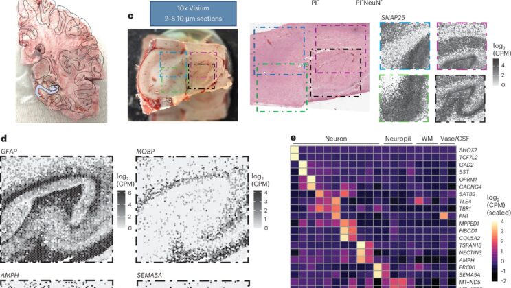 Scientists Built the Most Detailed Map of the Human Memory Center—And It Could Change Medicine Forever