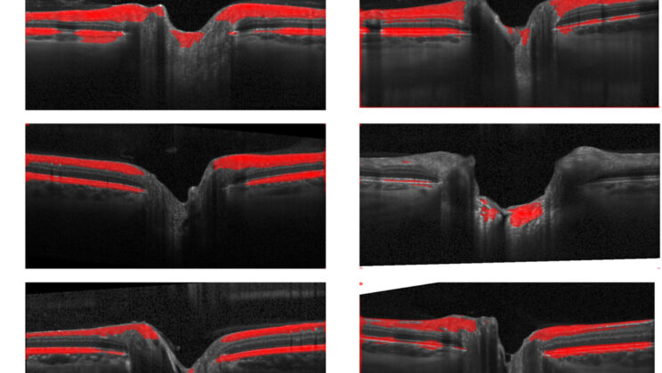 Space Is Making Astronauts Go Blind—AI May Have Found the Fix