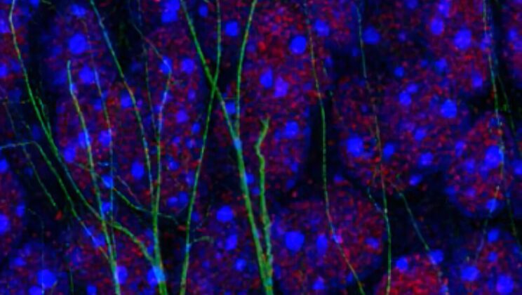 Your Brain’s Immune System May Be Erasing Memories—Here’s the Surprising Culprit