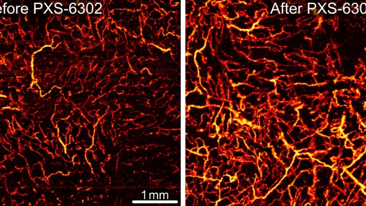 Scientists Test Cream That Could Soften Old Scars—And It Actually Works
