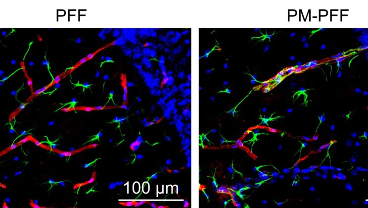 Scientists Find a Hidden Link Between Air Pollution and Dementia—And It’s More Alarming Than You Think