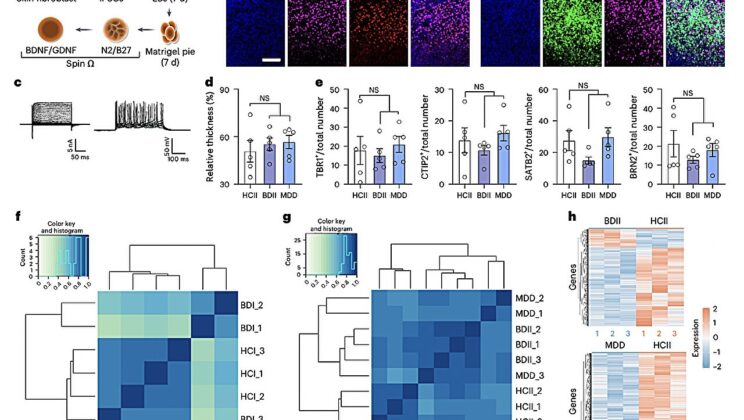 Bipolar Disorder May Start in the Pancreas, Not Just the Brain—Here’s Why