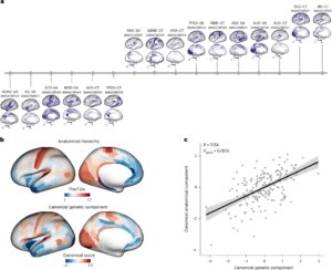 Your Genes May Be Quietly Reshaping Your Brain—and Influencing Mental