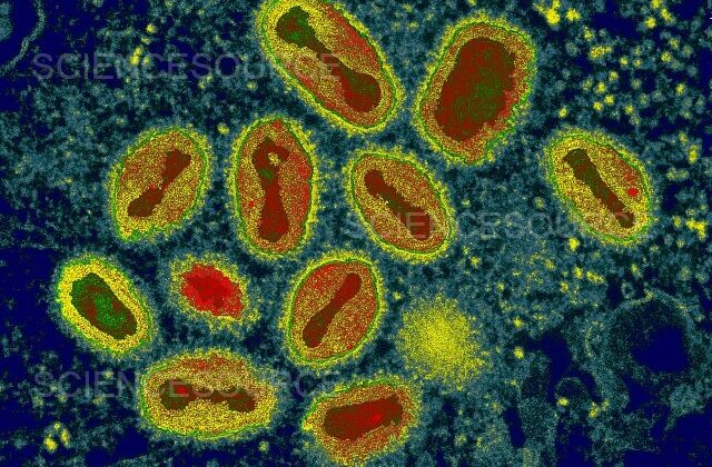 10 Most Dangerous Viruses in Human History