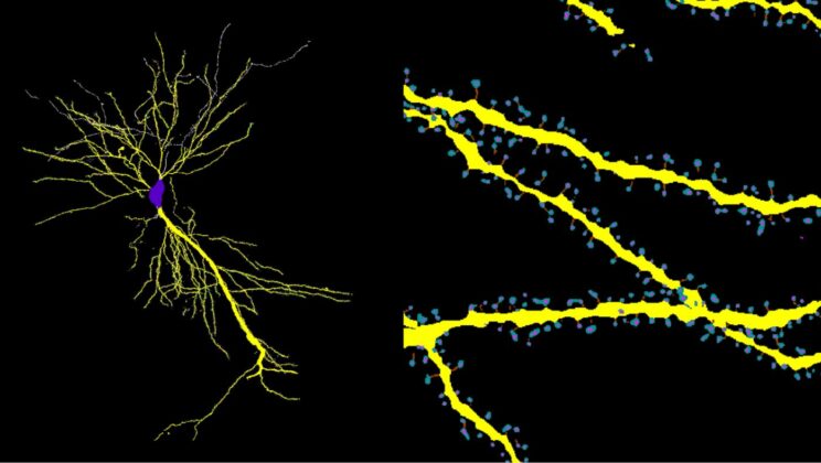 This Open-Source AI Can See Brain Damage Before Doctors Can