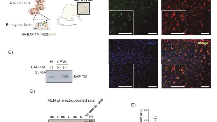 Scientists Find Brain Sends “Stress Bombs” That Ignite Gut Inflammation