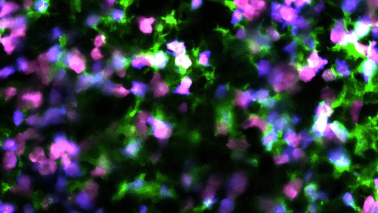 The Secret to Beating Cancer Might Be Hidden in the Way Cells Die — Here’s How