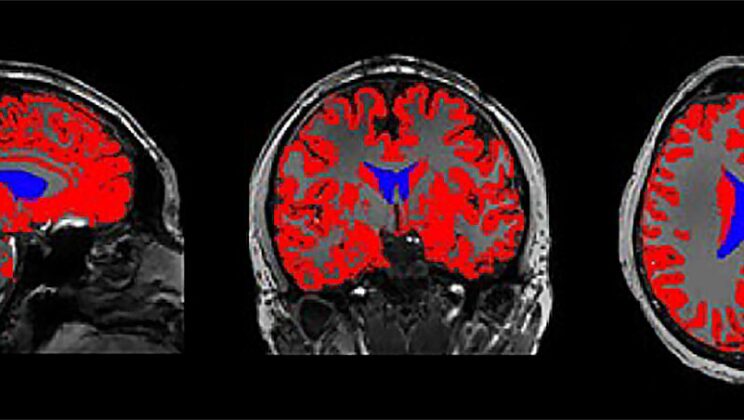 Scientists Uncover Mysterious “Brain Cleaning Waves” That Happen Only in Deep Sleep