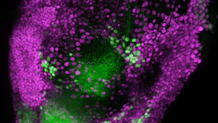 Scientists Discover Your Brain Doesn’t Smell “Good” and “Bad” the Way You Think