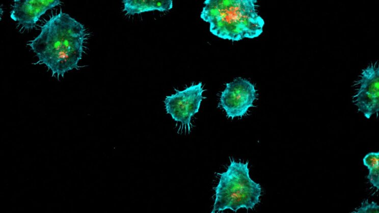 Scientists Discover Fat Molecules Secretly Guide the Body’s Killer Immune Cells