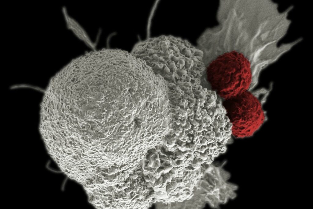 10 Best Breakthroughs in Cancer Research