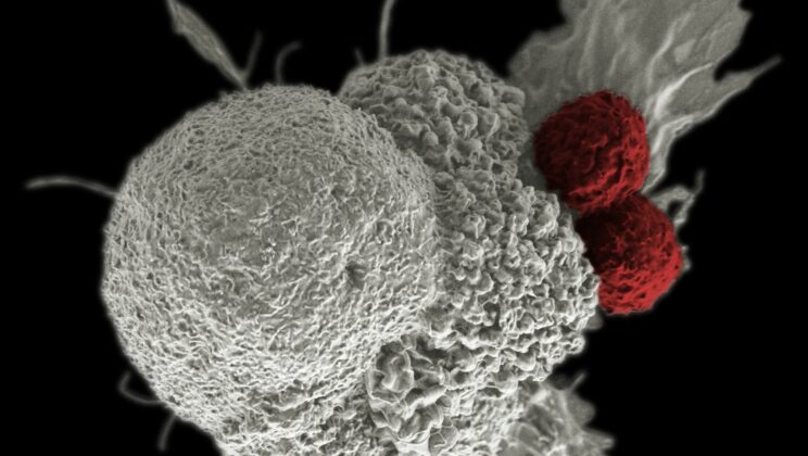 10 Best Breakthroughs in Cancer Research