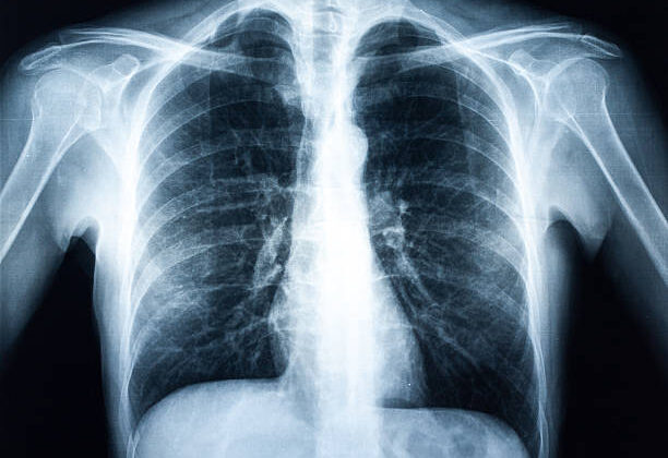 10 Most Important Medical Discoveries That Changed History