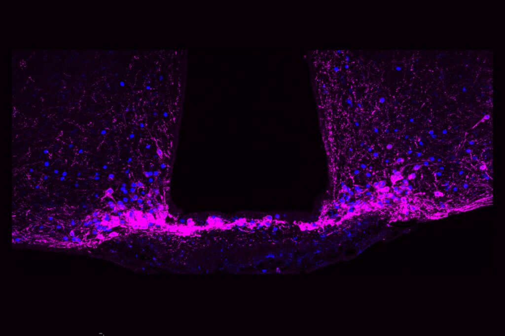 Scientists Discover The Brain S Hidden Off Switch For Chronic Pain