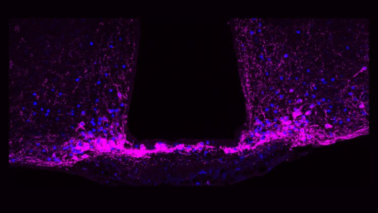 Scientists Discover the Brain’s Hidden “Off Switch” for Chronic Pain