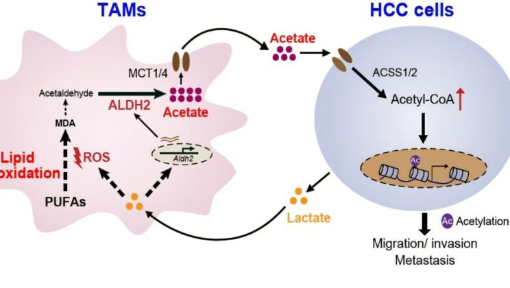 Liver Cancer Doesn’t Spread Alone — It Forces Immune Cells to Help, Study Reveals