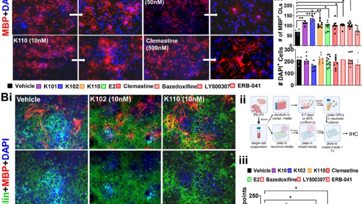 Scientists Discover New Drug That Could Reverse Nerve Damage in Multiple Sclerosis
