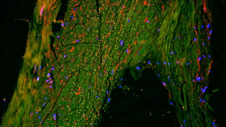 Scientists Discover Hidden “Drainpipe” in the Human Brain That Takes Out Its Trash