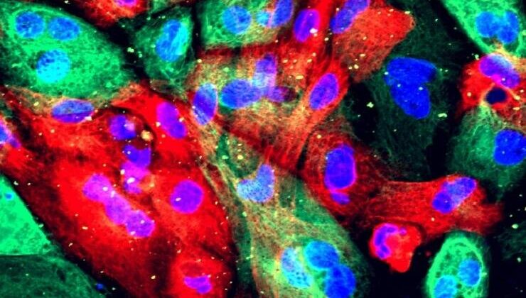 Scientists Uncover Hidden Weakness in Prostate Cancer — And It Could Transform Treatment Forever