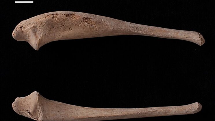 Archaeologists Uncover 900-Year-Old Child Skeleton with Mysterious Rare Disease That Still Baffles Scientists