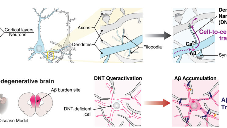 Scientists Discover Hidden Brain Bridges That Could Explain How Alzheimer’s Spreads