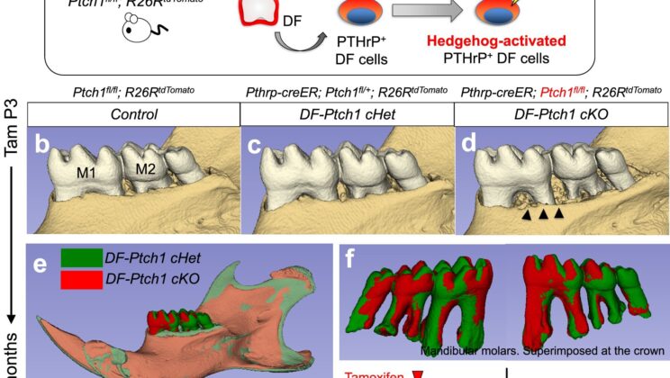 Scientists Discovered the Secret to Regrowing Teeth — And It’s Hidden in Stem Cells