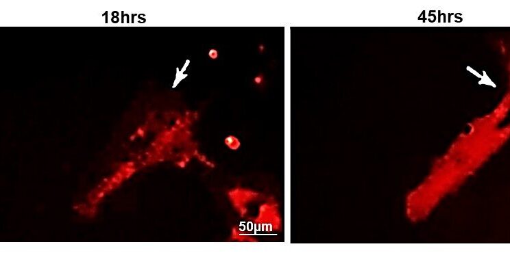 Scientists Reactivate “Sleeping” Gene That Lets the Human Heart Heal Itself After a Heart Attack