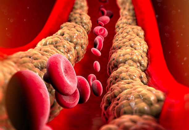 This New Pill Could Cut Cholesterol by Over 50%—Here’s How It Works