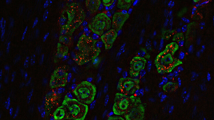 Scientists Discover Nasal Drops That Could Defeat Deadly Brain Cancer