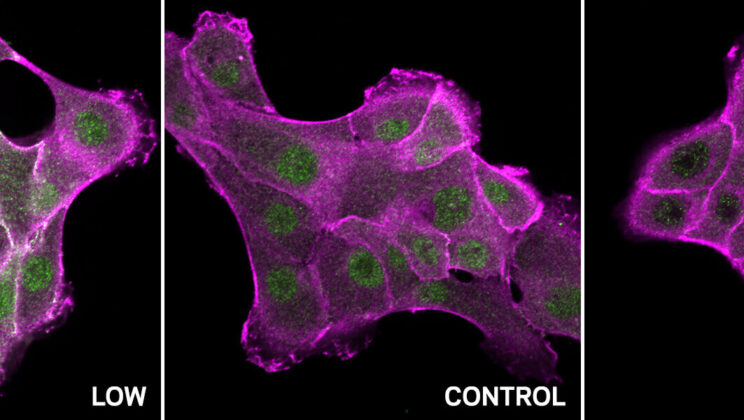 Scientists Create AI-Powered Tool That Can Predict Cancer-Causing Protein Changes Before They Happen