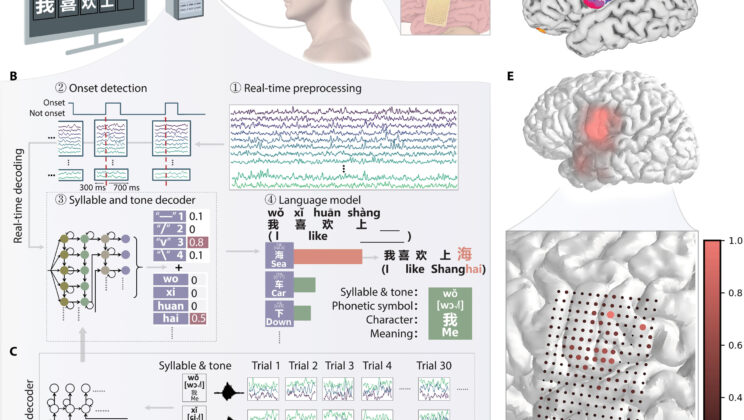 She Couldn’t Speak — Until a Brain Chip Helped Her Think Words into Existence