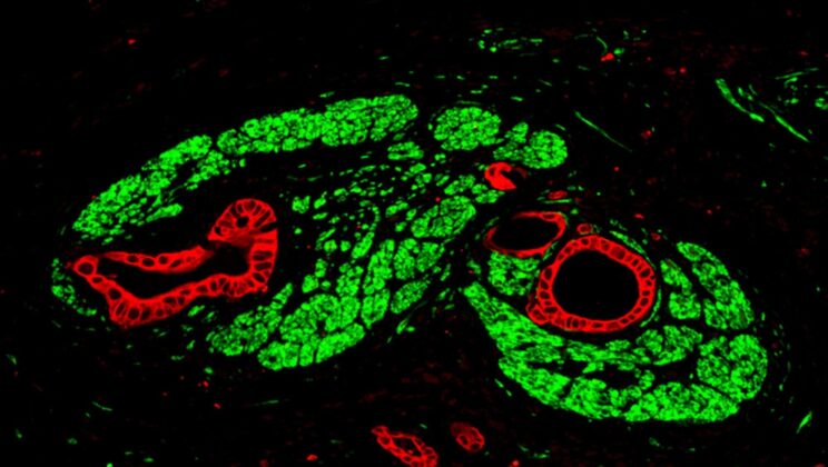 Scientists Discover Pancreatic Tumors “Hack” the Nervous System to Grow Faster