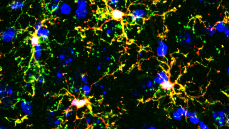 Your Anxiety Might Be Controlled by the Brain’s Immune System, Not Your Thoughts