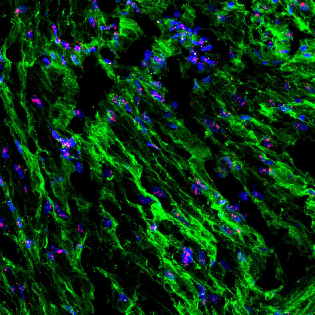 Scientists Discover the Uterus Has “Pressure Sensors” That Help Control