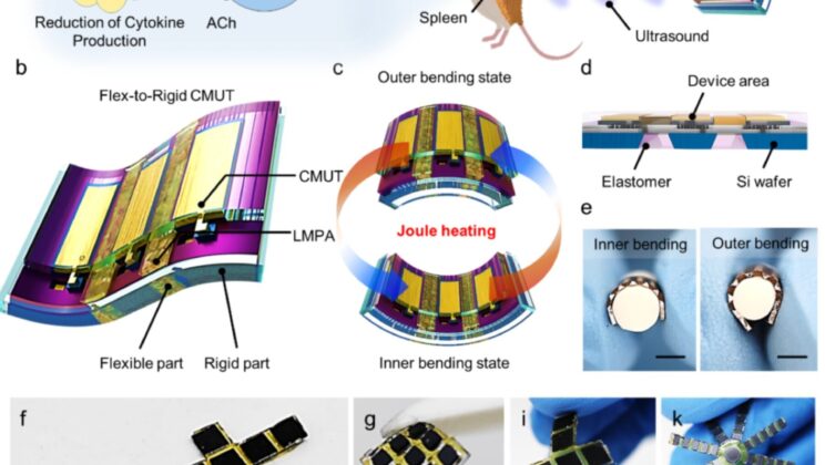This Shape-Shifting Ultrasound Patch Could Transform How We Heal Our Bodies
