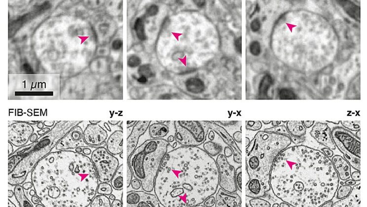 Scientists Capture 3D Brain Circuitry in Mice Using X-Rays—No More Tissue Slicing!