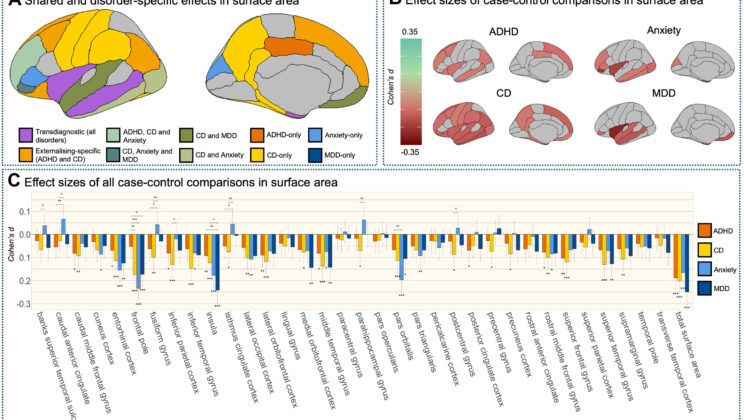 Scientists Discover Shocking Similarities in the Brain Structures of Kids with ADHD, Anxiety, and Depression