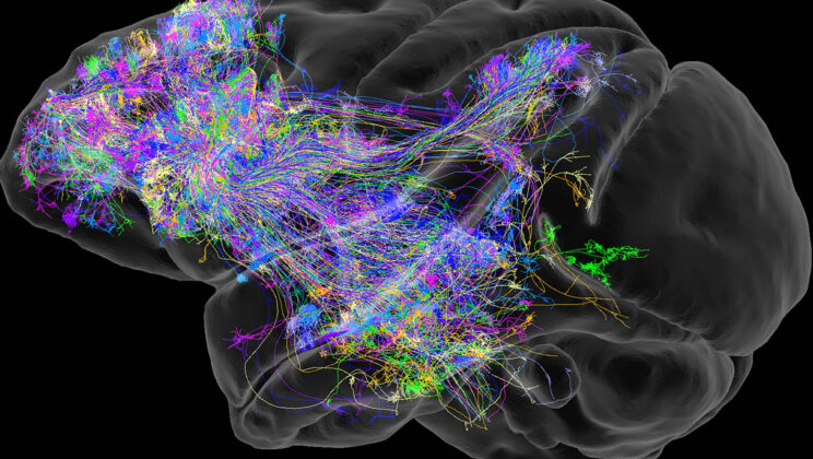 How AI Is Mapping the Human Brain Better Than We Can