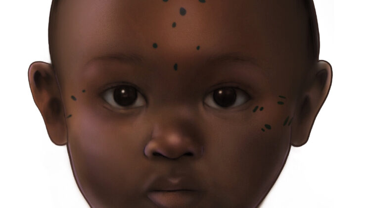 Ancient Tattoos on Babies? New Imaging Reveals Nubian Infants Were Marked Nearly 1,300 Years Ago