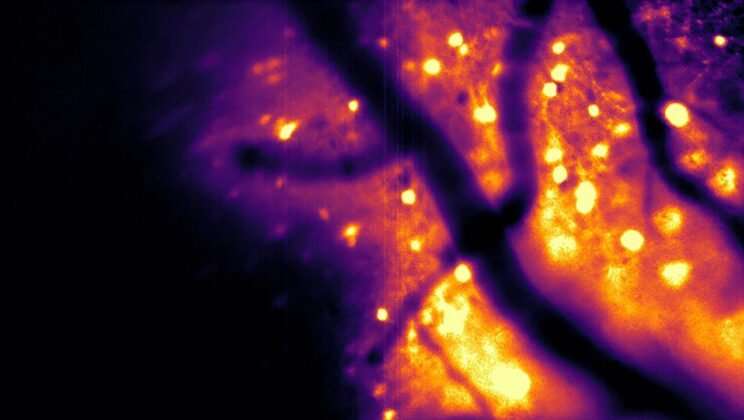 Scientists Made Brain Cells Glow From Within—And It Could Change Neuroscience Forever