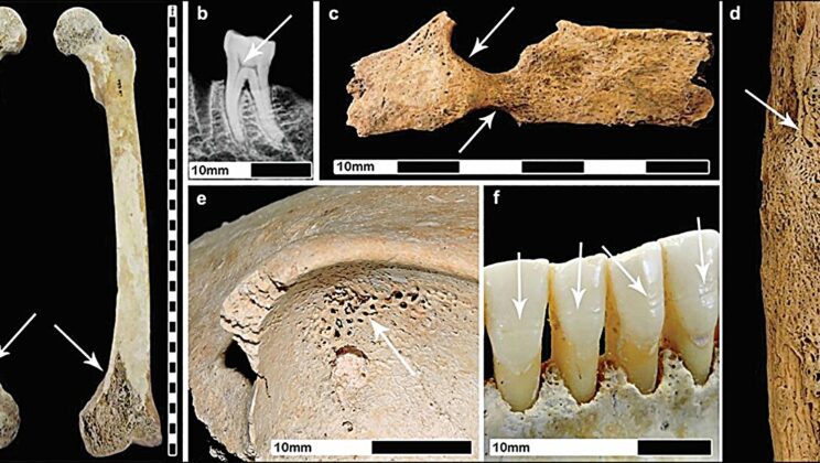 Mother and Child Bones Tell a Dark Story of Roman Urban Life