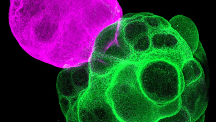 Scientists Grow a Miniature Human Brain Circuit and Discover Who’s Really in Charge