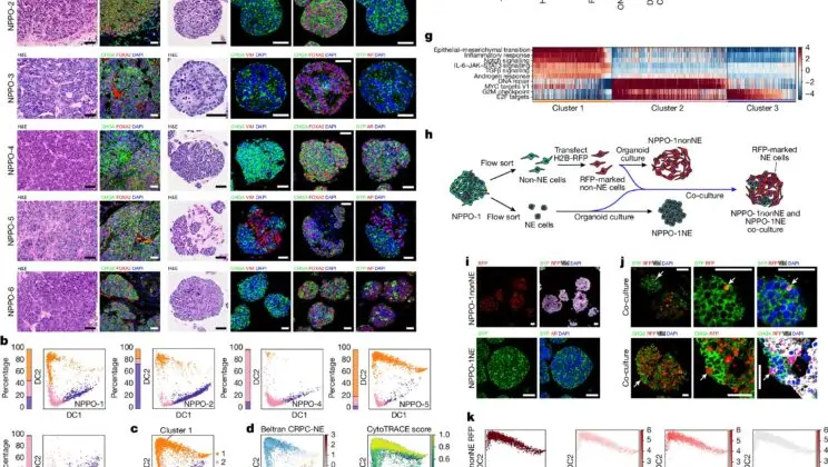 Scientists Find a Way to Reverse Prostate Cancer Drug Resistance — And It Hinges on One “Undruggable” Enzyme