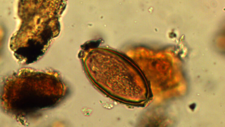 Roman Soldiers Didn’t Just Fight Enemies—Their Own Guts Were Under Siege, New Study Reveals