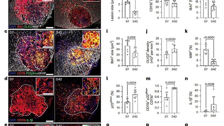 Scientists May Have Found Why Progressive MS Never Stops — and the Answer Was Hiding in Plain Sight