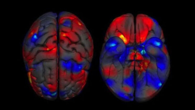 6 Surprising Differences Between the Male and Female Brain