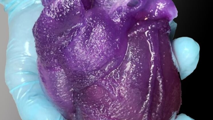 3D Bioprinting: Can We Print a Functioning Human Heart?